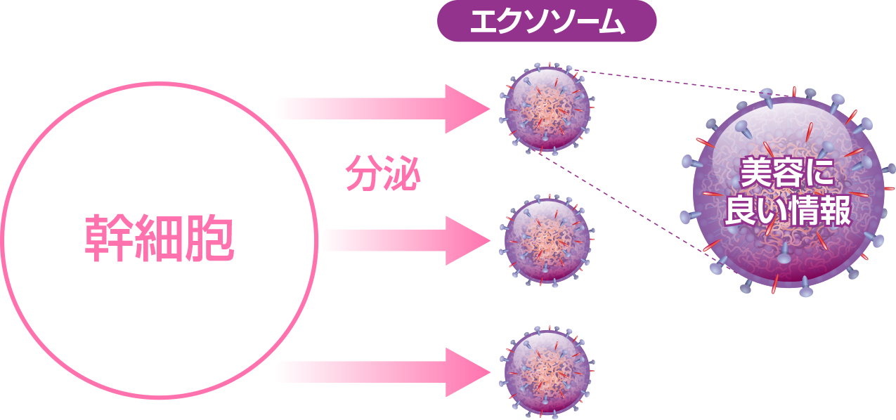 エクソームとは
